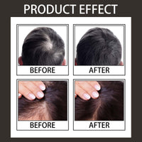 Hair Concealer,Hair Loss Concealer,Root Touch Up Hair Color,Water & Sweat Resistant Hair Loss Con-cealer,Easily Cover Loose Ha-ir,R-oot Cover Up,Ha-ir Root Touch Up,H-air Fibers for Men,Root Co-ver Up