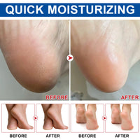 Urea Foot Care Stick, Urea Foot Cream Moisturizer for Dry, Cracked Heels & Thickened Skin, Hydrates & Nourish Foot Care for Softens Skin Exfoliates Dead Skin, Fast Absorbing & Non-Greasy, 1.41 OZ