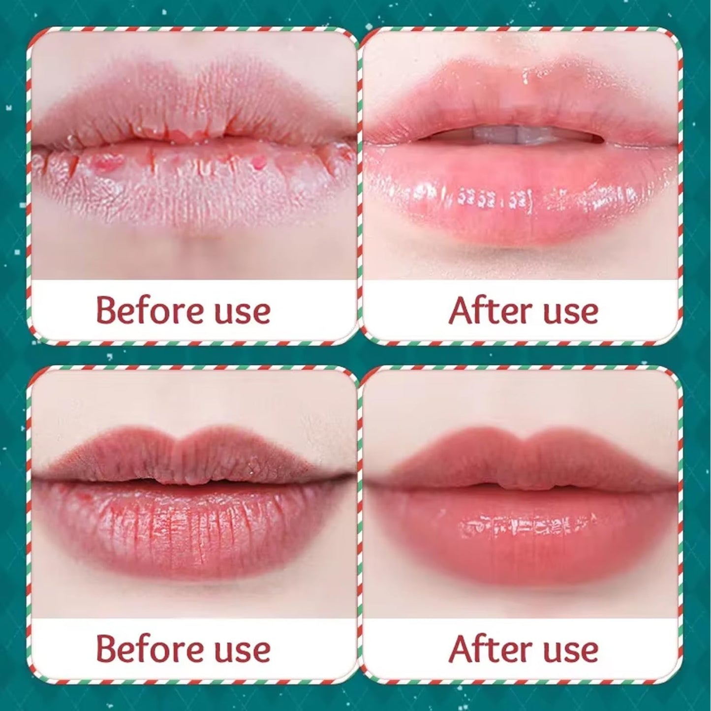 SHEBEEDO Christmas Lip Balm Set,Mini Lip Sleeping Mask Set+Lip Balm Set,Day And Night Repair For Chapped Cracked Dry Lips,Moisturizing Lip Mask Multipack,Natural Bright,Reduce Lip Lines&Wrinkle,Gifts For Women