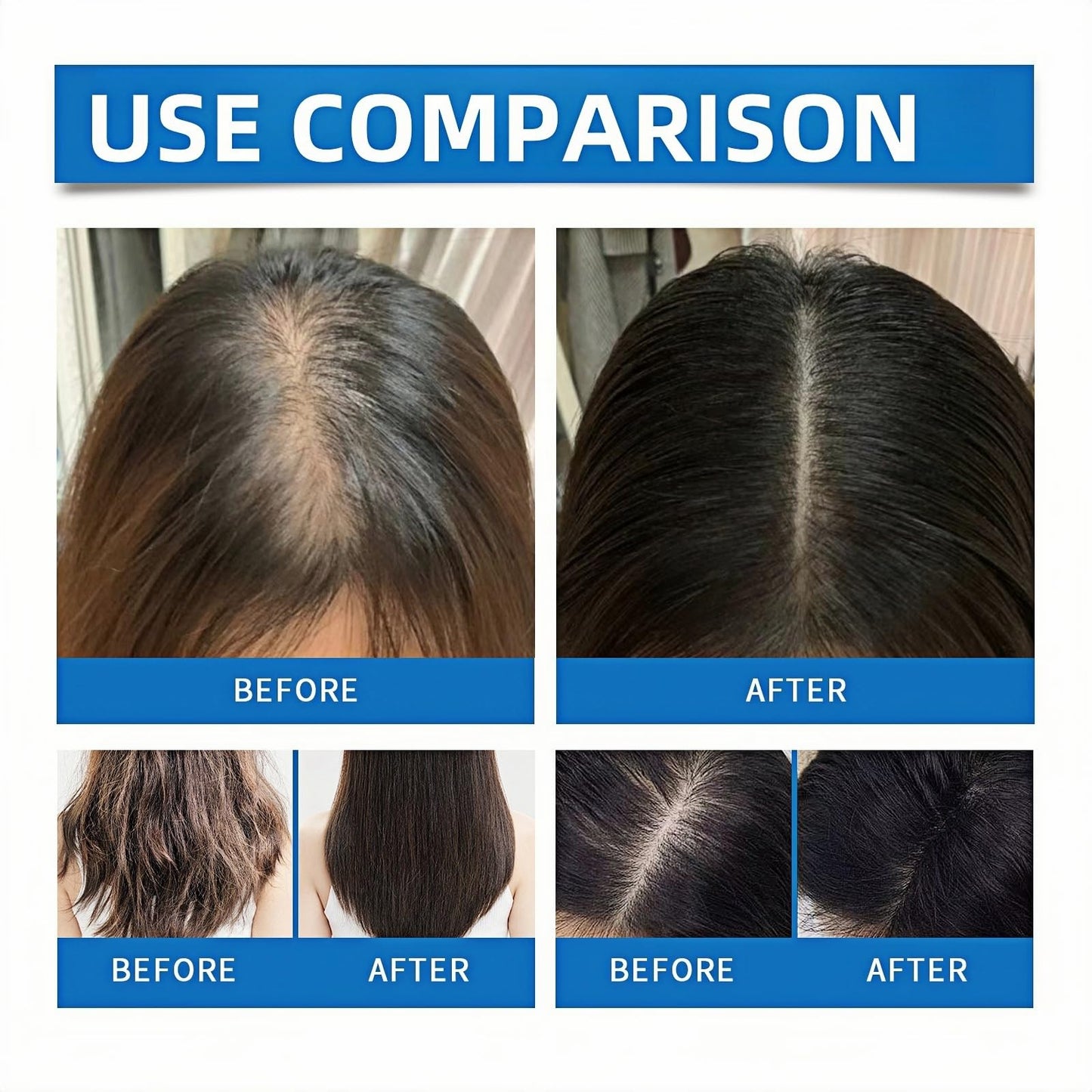 Sca-lp Cooling Hair Ampoule, Hair Growth Serums for Hair Loss,Sca-lpy Ha-ir Gro-wth Serum for Men & Women,Ha-ir Loss Treatment for Women,Ha-ir Oil for Dry Damaged Ha-ir,Dry Ha-ir Treatments
