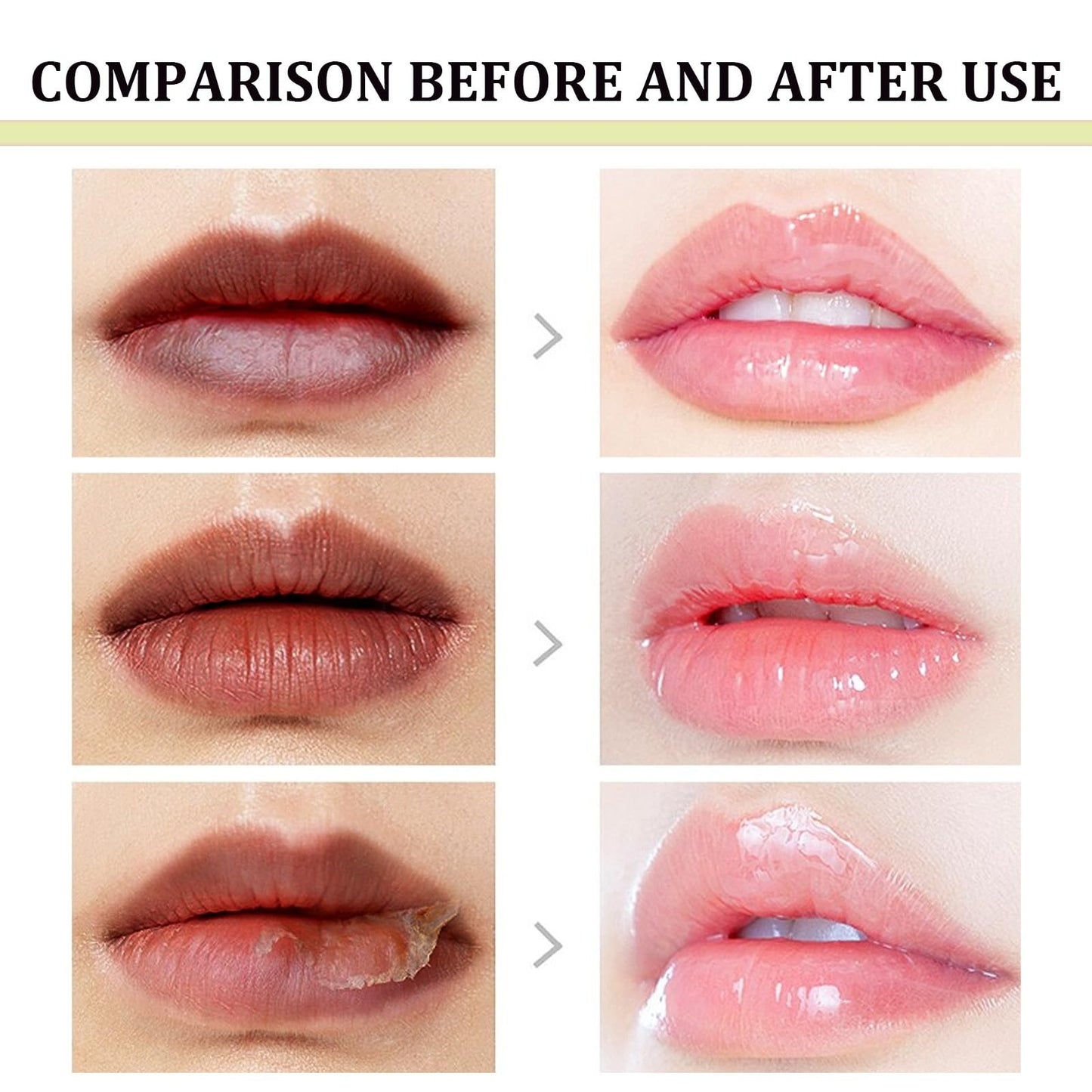 Dark Lips Cream,Lip Balm Lips Pink Bleaching Cream Balm,Lip Lightening for Dark Lips,Li-p Salve for Very Dry Lips,L-ip Lightening C-ream,Wrinkles Repair,Lip Pigmentation Treatment,L-ip Care