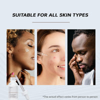 MIZEEYE Niacinamide Serum for Face, 2PCS Moisture Niacinamide Face Serum for Women, Niacinamide 10% + Zinc 1% Serum For Acne, Refreshing.