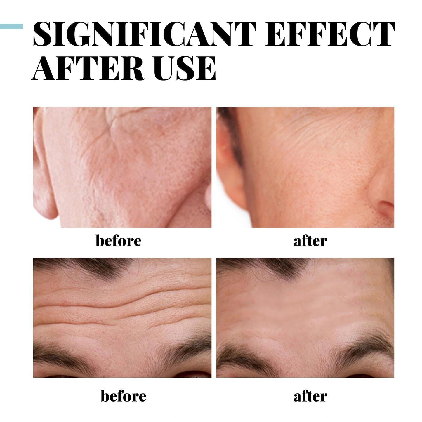 Yongst Men's Skin Tightening Face Cream - Moisturizer to Reduce Fine Lines and Wrinkles, Face Cream Moisturiser for Men, Anti Wrinkle Skincare for a Smoother, Youthful Appearance