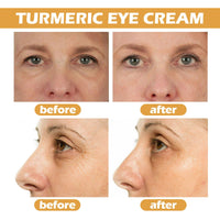 QUIWEN Turmeric Eye Cream, Turmeric Under Eye Cream, Eye Bags Remover, Anti Wrinkle Eye Cream, Firming Eye Cream, For Puffy Eyes, Moisturizes Eye Area