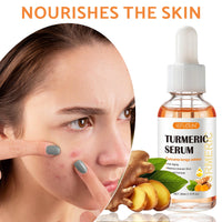 Leogony 2PCS Lightening Turmeric Serum Dark Spot Removal Corrector for Face Skin Glow, 30 ml, Anti Aging, Hydrating, Reduce Wrinkles