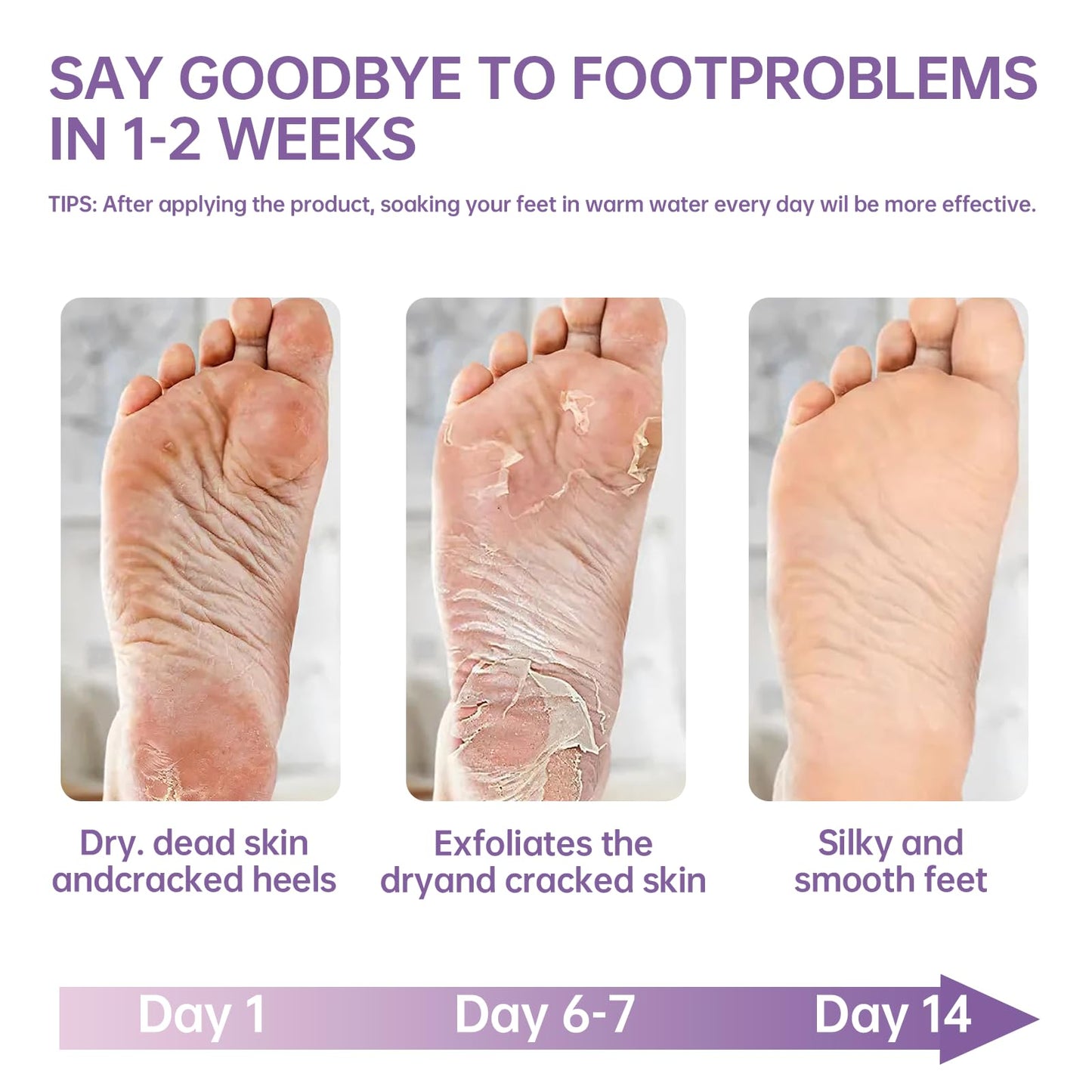 Generic 2 Pairs Foot Peel Mask for Hard Skin,Lavender Exfoliating Mask for Callus Remover Dead Dry Skin,Cracked Heel Treatment Socks, Plant Formula Moisturising Socks, Soft Foot Care