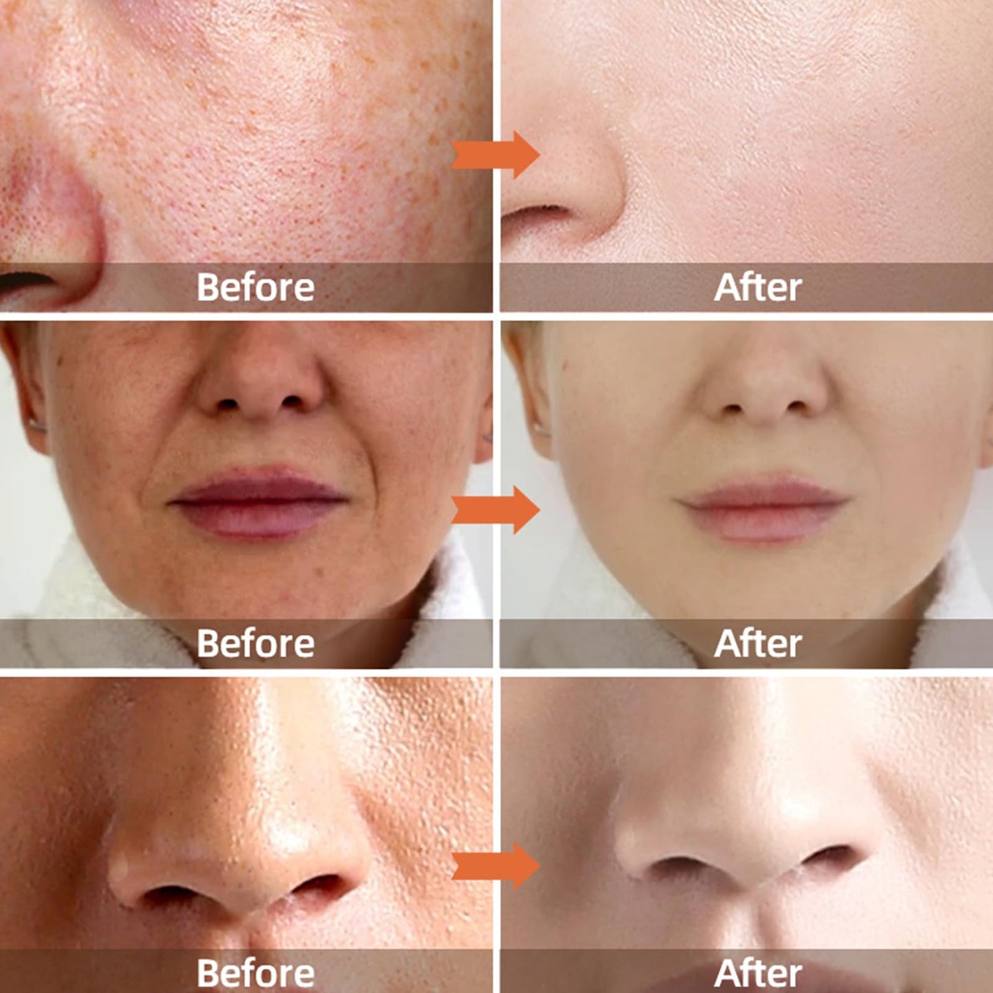 GNAUMORE Coconut Hydrate Facial Moisturiser,Coconut Oil Facial Moisturizer,Coconut Hydration Facial Lotion,Coconut Oil Body Lotion,Coconut Water Facial Moisturizer,Coconut Oil Formula Body Lotion