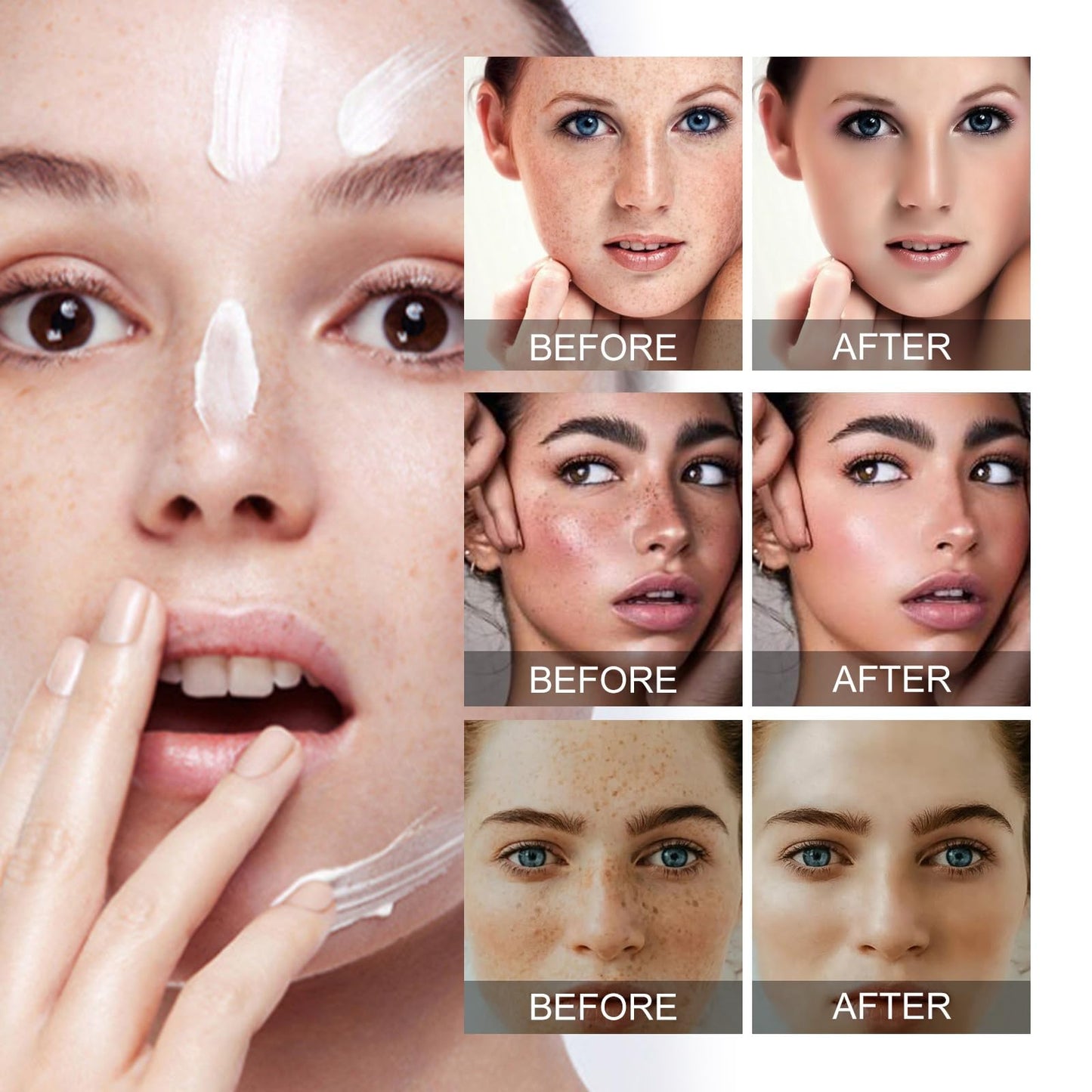 OuXing Dark Spot Correcting Glow Serum,Nicotinamide Facial Serum,5% Nicotinamide Seru-m,Spot Remover for Face,Hydrating & Brightening S-erum,Da-rk Spo-t Se-rum,Niacinamide Dar-k Sp-ot Remover,Face Ser-um