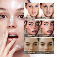 OuXing Dark Spot Correcting Glow Serum,Nicotinamide Facial Serum,5% Nicotinamide Seru-m,Spot Remover for Face,Hydrating & Brightening S-erum,Da-rk Spo-t Se-rum,Niacinamide Dar-k Sp-ot Remover,Face Ser-um