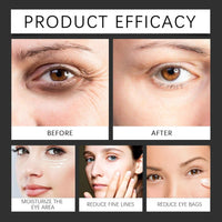 ALLILUYAA Harvey Ross Instant Lift Cream, Instant Lift Harvey Ross Cream, Eye Tightening Lifting Serum, Anti-Aging Face Cream For Tightener Skin, Lifting Loose Sagging Skin, Reduces Fine Lines & Wrinkles