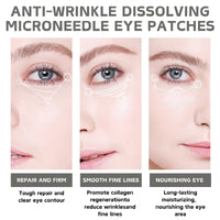 Cureluxe Pack of 3 Micro Needle Patches - Dissolving Microneedle Eye Patches with Vitamin E,Collagen,Hyaluronic Acid - Anti-Wrinkle Microneedle Patches - Collagen Eye Patches for Dark Circles & Puffy Eyes