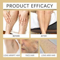 SHEBEEDO Cyperus Rotundus Oil, Cyperus Rotundus Oil for Hair Removal, 100% Pure Cyperus Oil Hair Inhibitor, Decrease Hair Growth-With Dropper, Natural Body Hair Reduction, Moisturizing and Nourishing