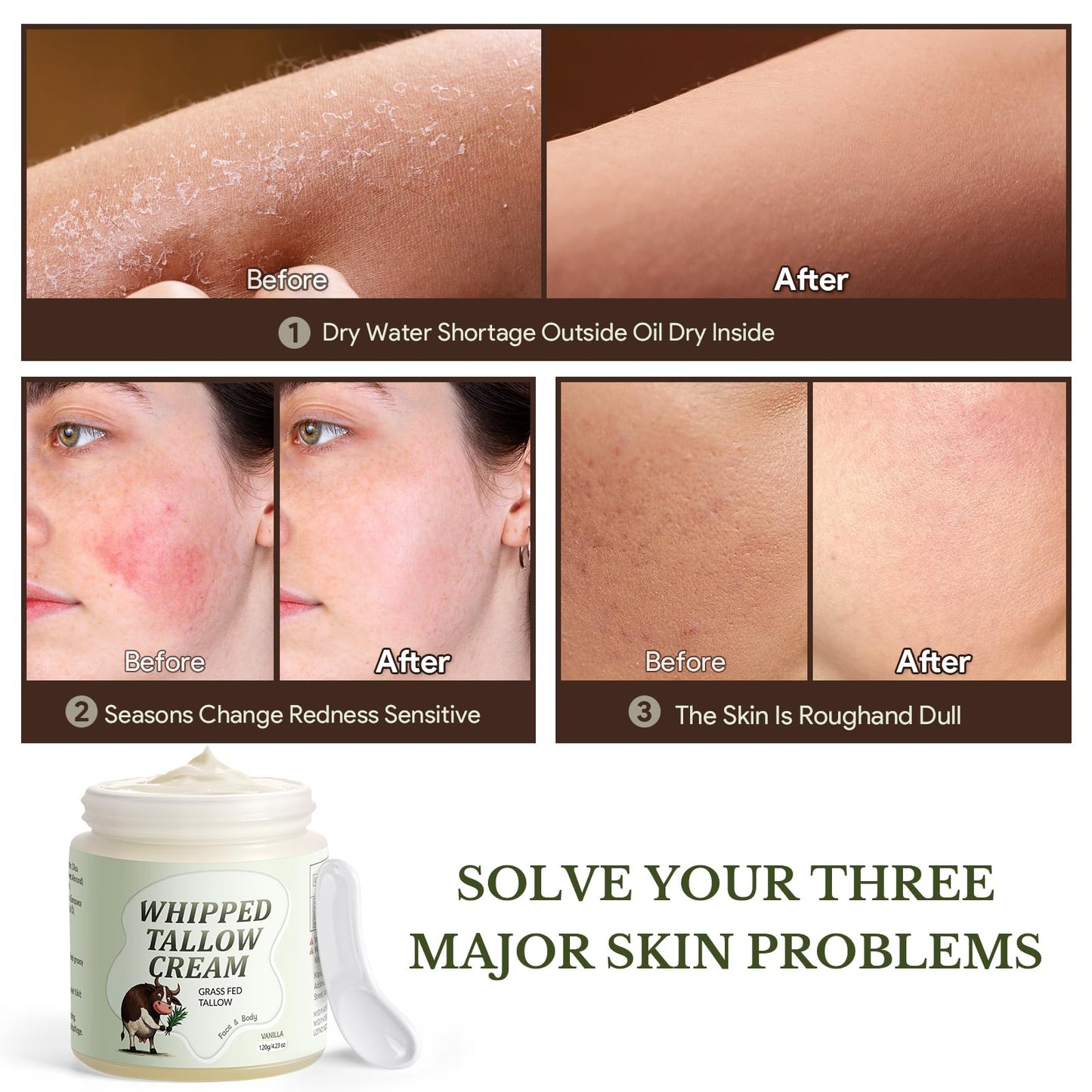 Beef Tallow Skin Care, Whipped Tallow Face Cream, Beef Tallow Moisturiser for Face & Body, Natural Grass Fed Beef Tallow, Skin Care Cream for Dry Skin, Vanillin, 120g