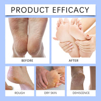 Beauthink 60% Urea Foot Cream - for Cracked Heels & Dry Skin, Cracked Heel Repair Cream For Feet and Hand, Intensive Moisturizer for Deep Hydration, Moisturize Rough on Feet, Hands & Body