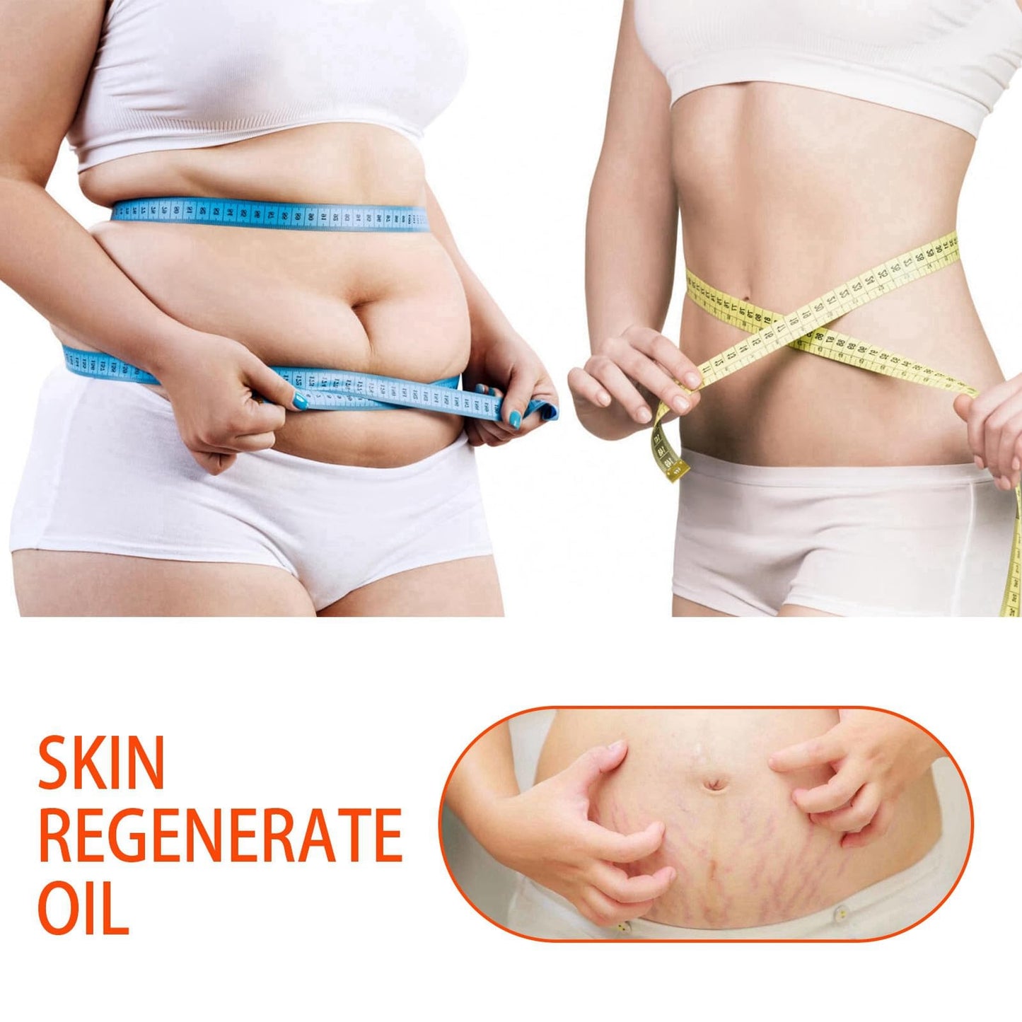 HIVETZ 125ml Optimal Oil,Collagen Boost Firming Lifting Skincare Oil,Skin Regenerate Oil,Body Oil for Women,Stretch Mark Oil,Stretch Marks Removal,Body Skin Care Improves Appearance of Stretch Marks