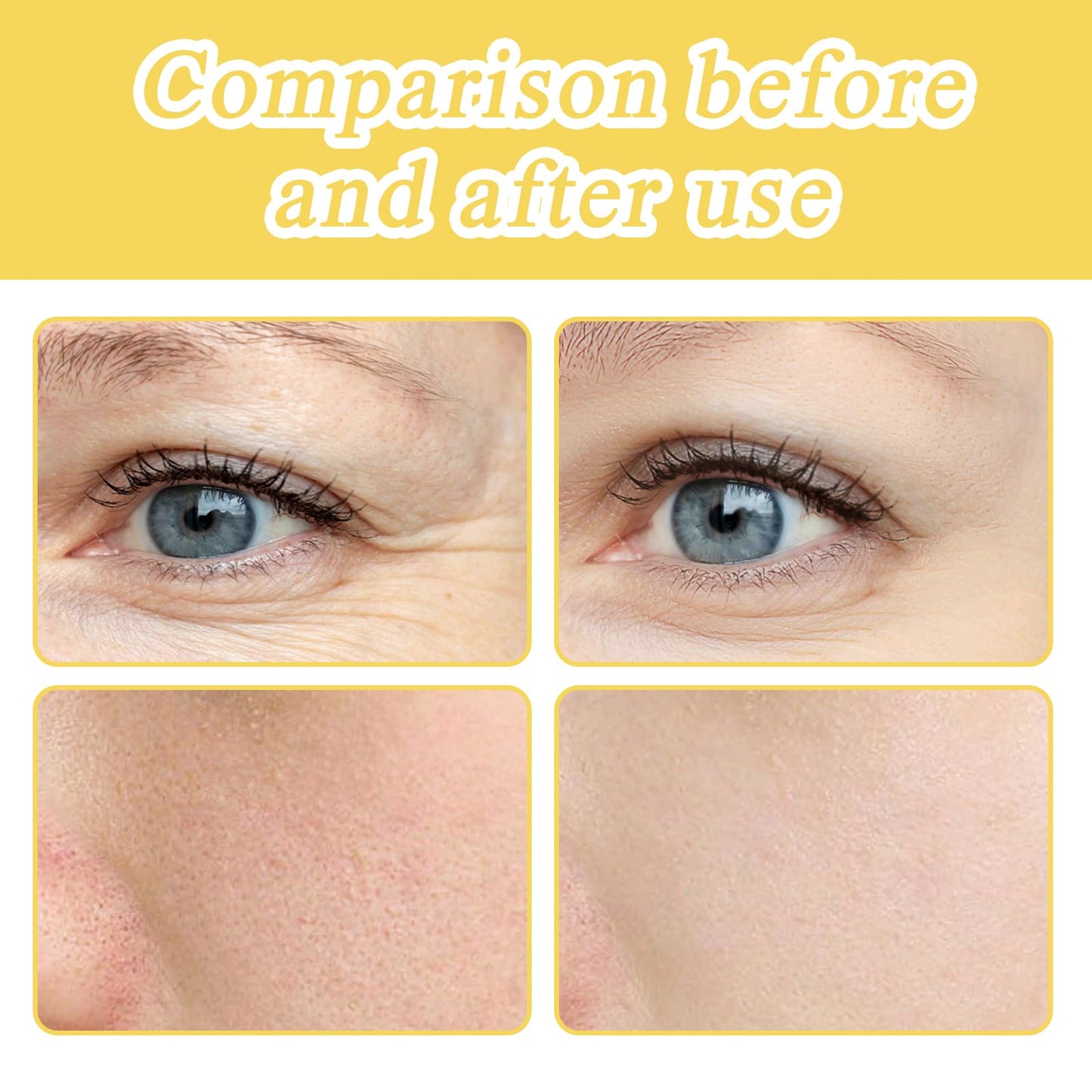 MADGININE 3 Pcs Frankincense Oil for Skin, Frankincense Oil, Frankincense Resin Oil, Deeply Nourishing, Light and Non-Sticky, Improve Skin Conditi, Frankincense Resin Oil for Skin Care