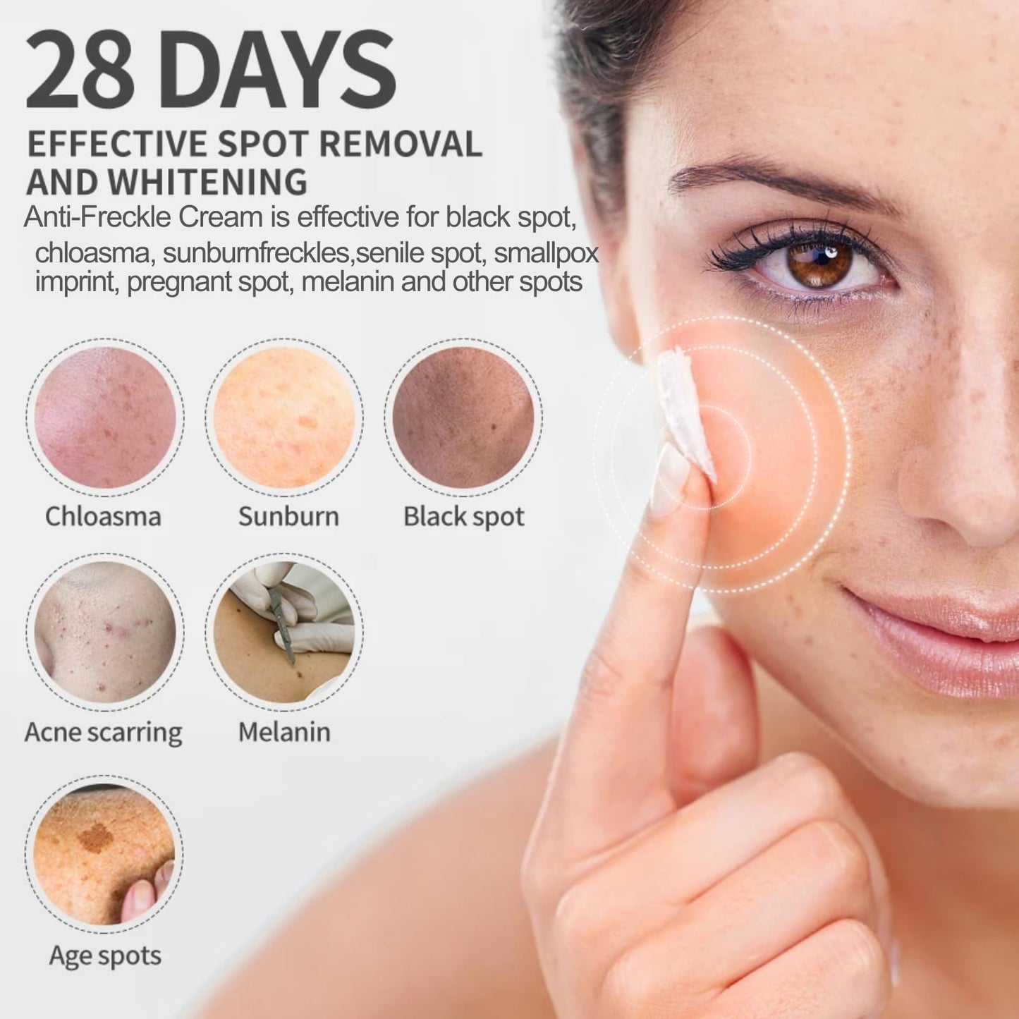 Tianyue Freckle Removal Cream,Anti-Freckle Crea-m- Dark Spot Removal Cream with Niacinamide & Vitamin C,Dark Spot Remover for Face & Body,Whitening Freckl-e Crea-m, Reduces Melasma,Improve Skin Dullness