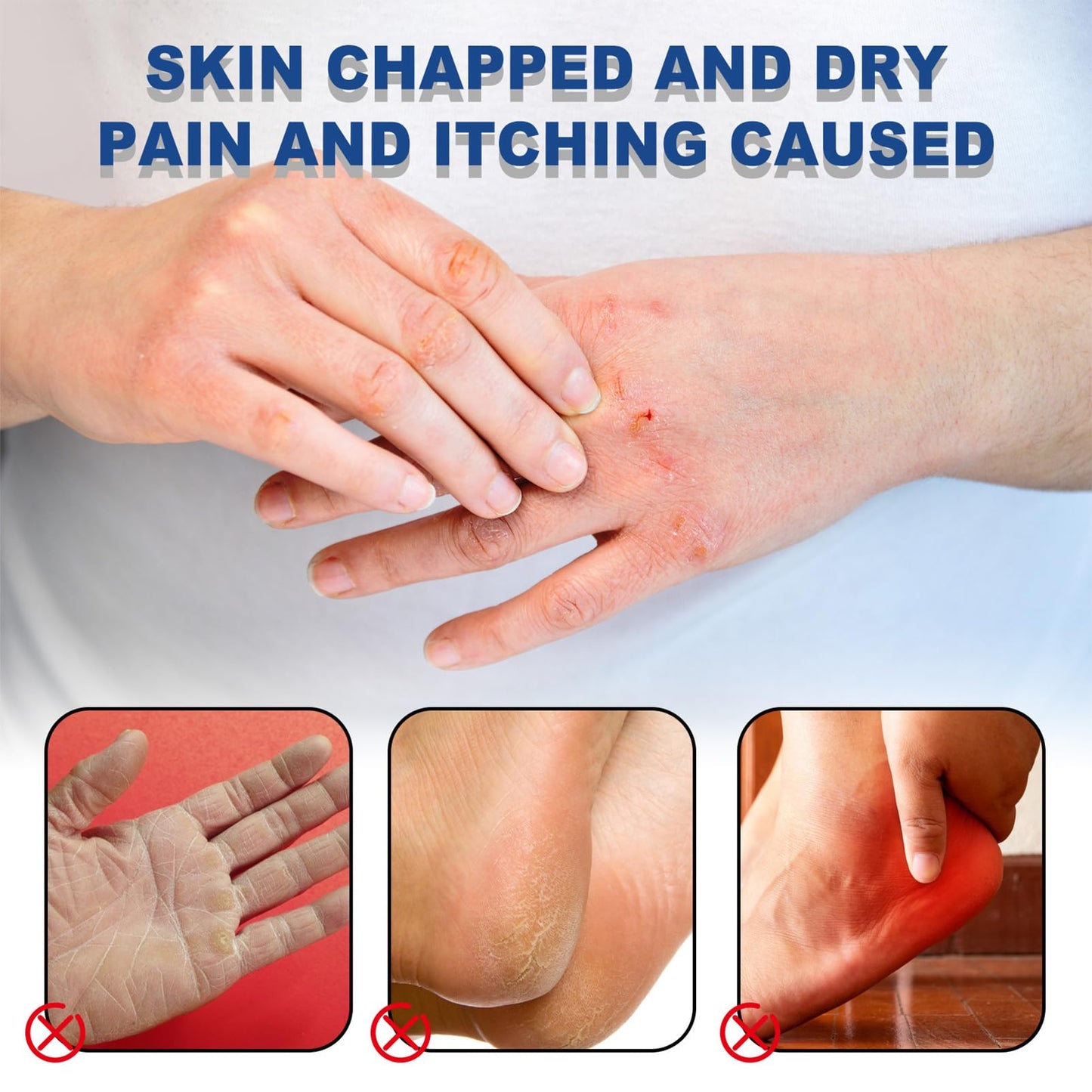 KAYZON 42% Urea Cream, Cracked Heel Balm, Urea Foot & Hand Cream for Dry Cracked, Callus and Dead Skin Remover, Foot Moisturizing Stick for Cracked Heel Treatment Knees Elbows Hands Repair, Feet Lotion