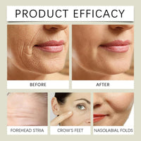Yoowan Freckle Removal Cream,Skin Barrier Repair Cream,Oil Free Moisturiser,Anti Wrinkle Balm Instantly Lifts/Tightens/Resists Aging/Lightens Fine Lines,Deep Facial Moisturizing,Soothing,Relieve Swelling