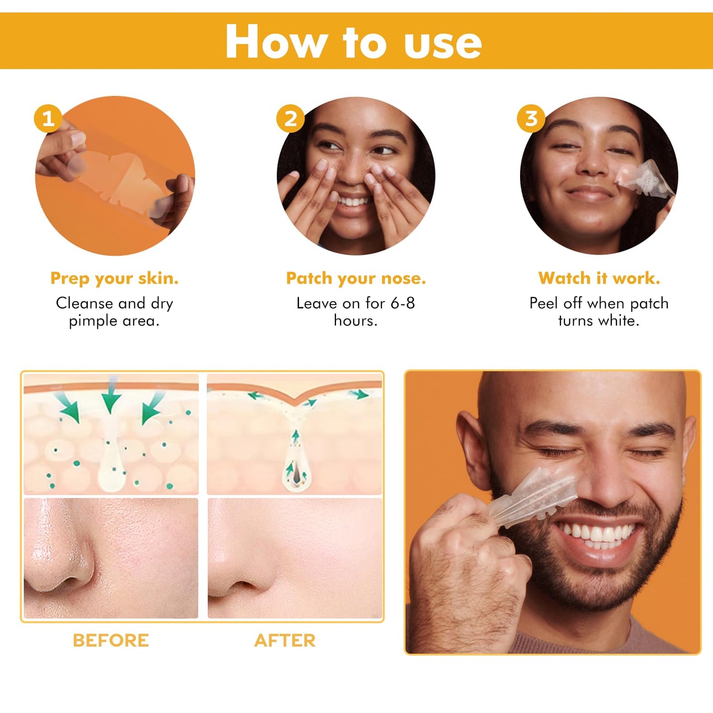 Generic Hydrocolloid Nose Strips for Blackhead Removal, Deep Cleansing Pore Strips to Absorb Oil and Dirt, Acne Treatment Patches for Nose, Invisible Spot Stickers for Men and Women (10 Count)