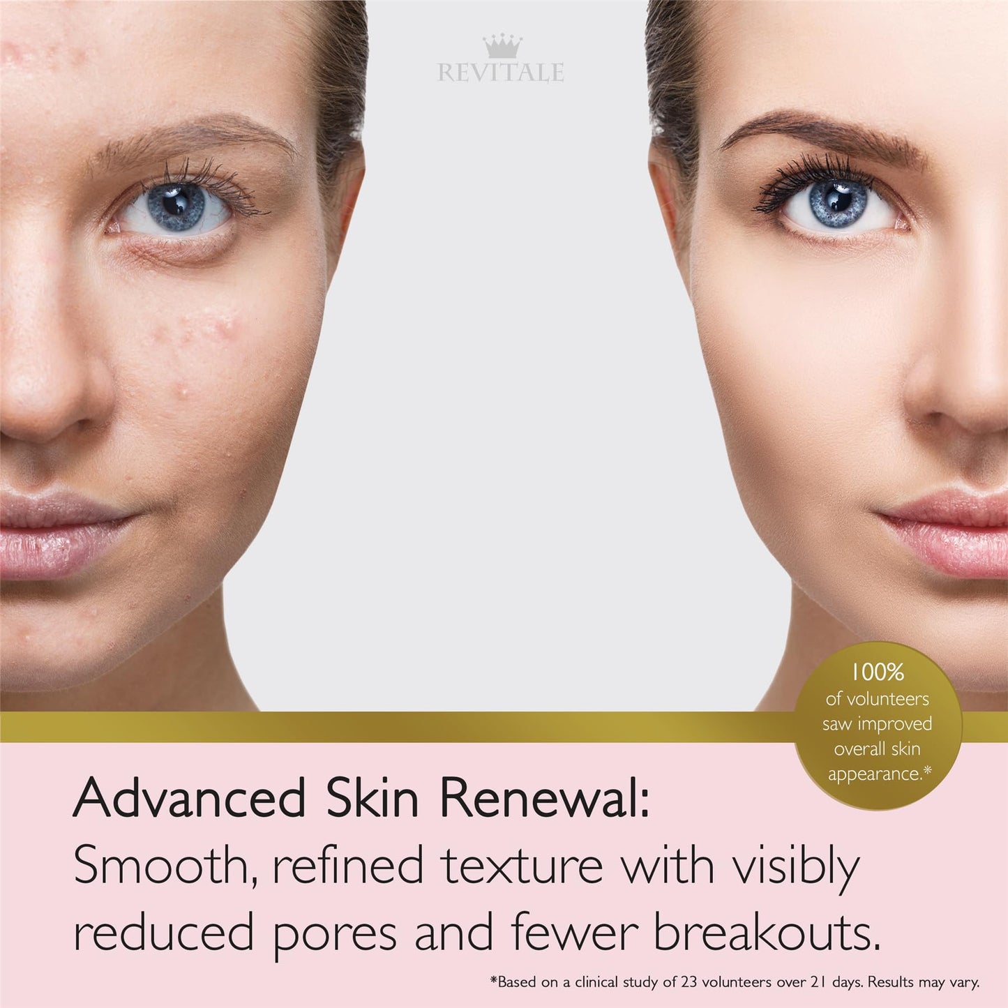 Revitale Advanced Salicylic Acid Cream for Face & Body 80g – Helps Smooth & Soften Skin Texture. For Rough, Bumpy & Blemish-Prone Skin