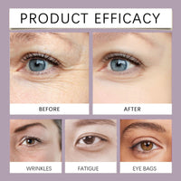 Electric Eye Cream,Eye Cream for Dark Circles and Puffy Eyes,Organic Eye Repair Cream,E-ye Bags Remover,Ey-e Cre-am for Wrinkles,Firming Ey-e Cr-eam,E-ye Serum for Dark Circles,Eyecare Products