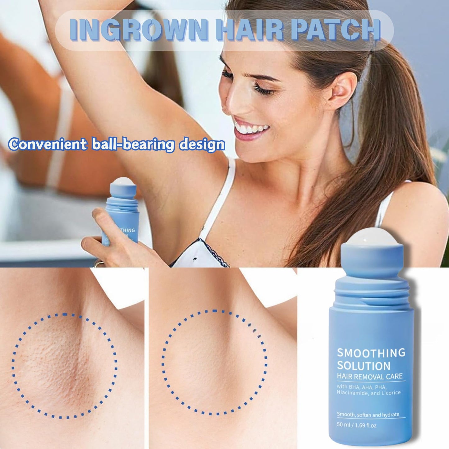 IZBEAUVO 2pcs Razor Bump Smoothing Solution Ingrown Hair Treatment with BHA AHA - High Roller Ingrown Tonic for Underarms Abdomen - Ingrown Hair Serum for Men & Women