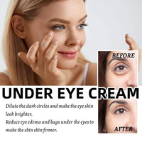 Jinjiar Lumi Eye Balm for Under Eye Bags,Erases Eye Bags within Minutes,Anti Aging under Eye Cream,Lumi Eye Balm Serum,Eye Cream for Dark Circles and Puffy Eyes,Eye Bags Remover,Eye Cream for Wrinkles,Eye Bag