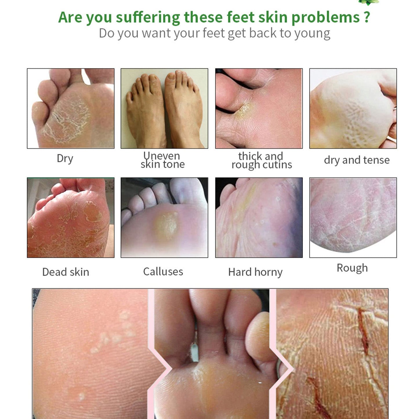Tongyend Foot Peel Mask,3Pcs Natural Aloe Vera Gel Foot Mask,Foot Peel Mask For Hard Skin,Exfoliating Feet Peeling Socks,Foot Callus Remover,Foot Care,Feet Hard Skin Remover,Pedicure Sets For Feet (Aloe Vera)