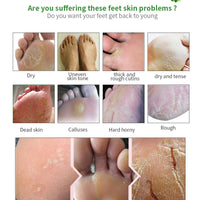 Tongyend Foot Peel Mask,3Pcs Natural Aloe Vera Gel Foot Mask,Foot Peel Mask For Hard Skin,Exfoliating Feet Peeling Socks,Foot Callus Remover,Foot Care,Feet Hard Skin Remover,Pedicure Sets For Feet (Aloe Vera)