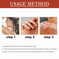 Exfoliating Yellow Peeling Oil for Da-Rk Skin,Body Glow Oil,Exfoliator Body,Brightening Bo-dy O-il,Bo-dy Exfoliate Peeling Oi-l,Whole Bod-y Sk-in Exfoliator,Bod-y O-il for Women,Sk-in Lightening
