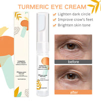 Turmeric Eye Cream, Turmeric Under Eye Cream for Dark Circles, Eye Bags Remover, Under Eye Brightener, Eye Cream Anti Aging, For Puffy Eyes, Dull Eye Skin, Fine Lines, Firming, Hydrating, Moisturizing
