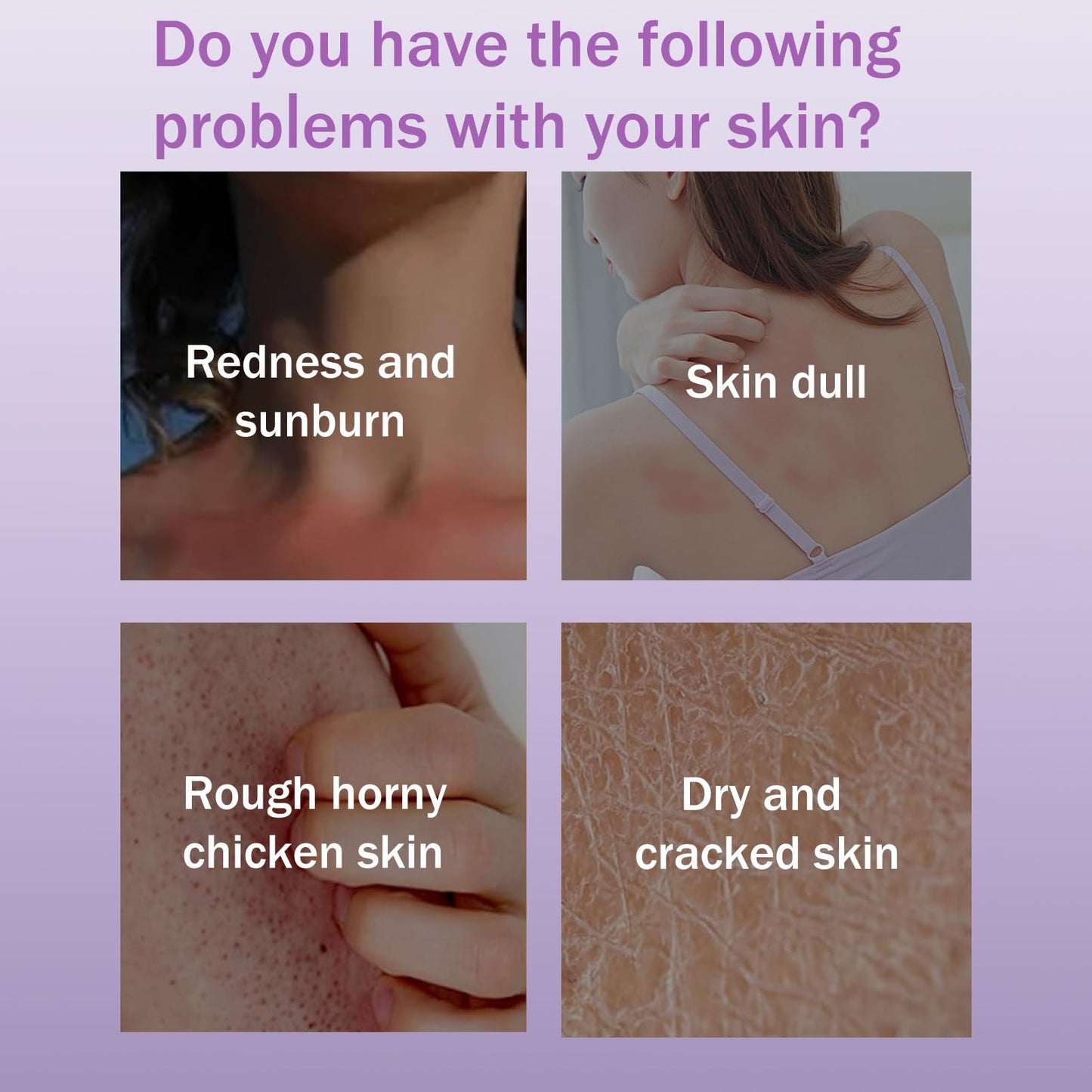 Lavender Body Oil Gel- Body Moisturising for Women Relaxing Skin Care - Vitamin E Oil For Skin - Body Moisturiser for Anti-Wrinkles & Reduce Fine Lines - Body Oil For Women - Hydrating Body Skin Care