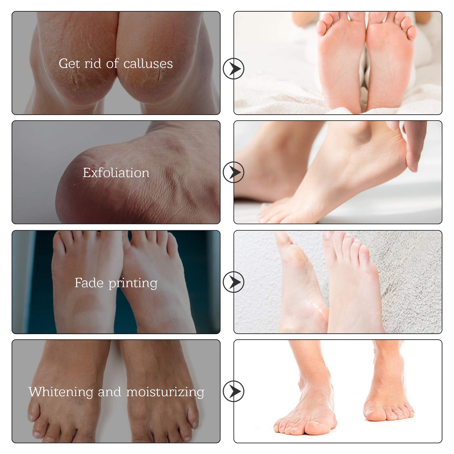 ALIVER 3 Pairs Foot Peel Mask, Foot Moisturizing Mask, Natural Lavender Exfoliating Foot Mask, Foot Skin Repair Socks for Dry, Aging, Cracked Heels Intense Skin Nutrition Foot Cream Mask