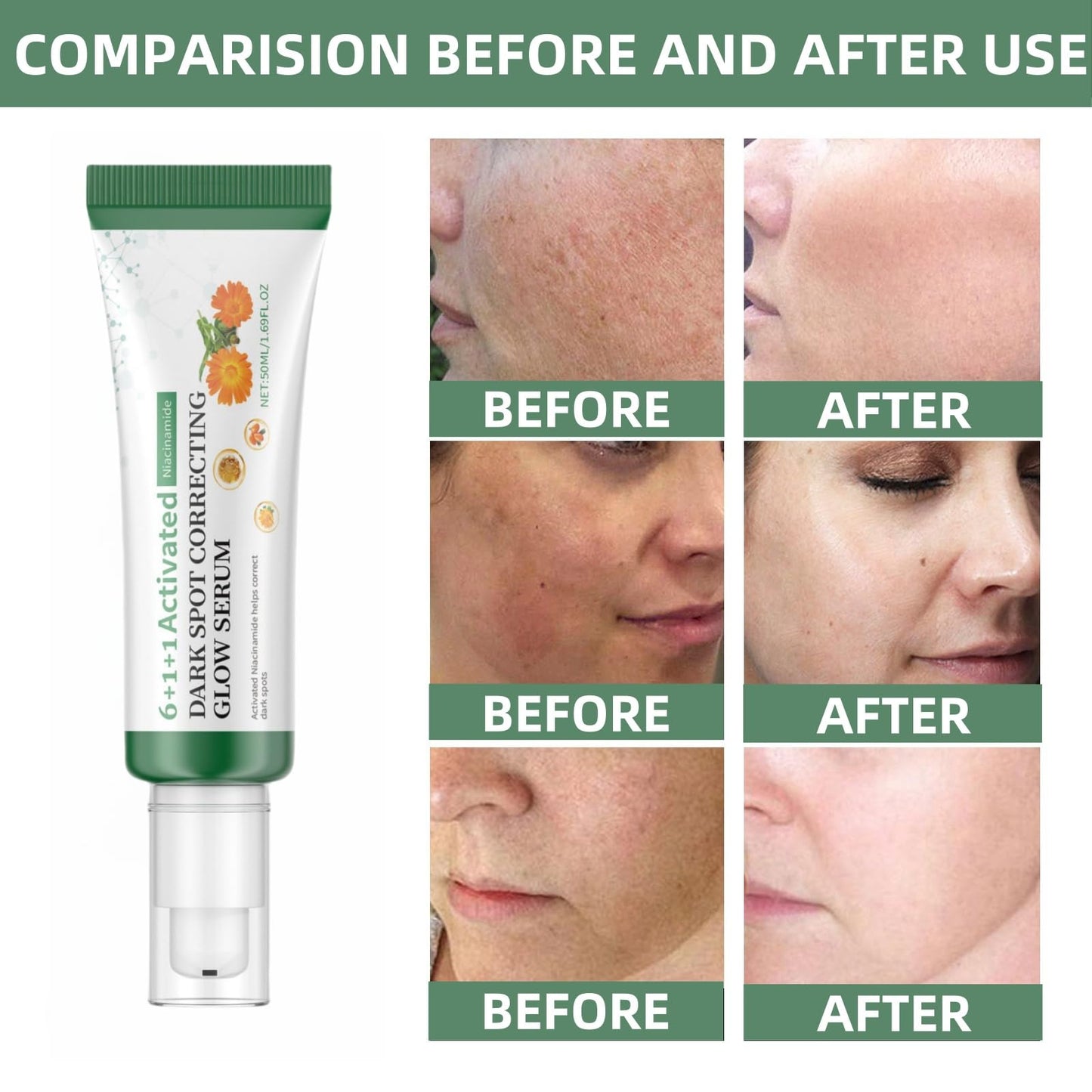 Siyinzu Dark Spot Correcting Glow Serum with 5% Niacinamide,Niacinamide Serum,Dark Spot Remover for Face,Skin Brightening Serums to Even Skin Tone,Dark Spots Correcting Serums,Face Serums Women,Facial Cream