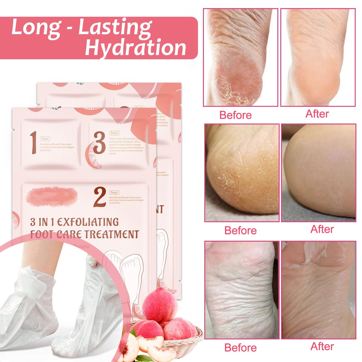 Shengqialun Foot Peel Mask With Peach Extract - Foot Mask For Hard Skin & Calluses - 3-In-1 Foot Care For Exfoliation, Moisturizing & Renewal - Natural Formula For Soft & Smooth Feet