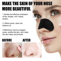 80 Pcs Blac/khead Remover Strips,Charco/al Pore Strips,Deep Cleansing Nose Str/ips Blac/khead,Nose Patches for Pores,Removes Bla/ckheads and Unclogs Po/res for Women and Men,Gentle and Skin-friendly