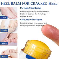 MrCuvaryas Urea Cream 60 Percent for Feet Set, Urea Foot Cream for Cracked Heels and Dry Skin, Cracked Heel Repair Cream For Feet and Hand and Body Care Hydrates, Softens & Exfoliates Women & Men