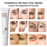 Retinol Eye Cream With Retinol Serum & AHA 30% & BHA 2% -Under Eye Cream For Dark Circles Puffy Eyes -Retinol Serum Moisturising Anti-Wrinkle Anti-Aging Eye Creams (Retinol Eye Cream)
