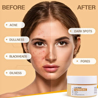 IZBEAUVO Turmeric Face Clay Mask with Kaolin Clay, Vitamin C Clay Mask, Deep Cleansing Pore Mask, Clay Face Mask, Mud Mask for Radiant Skin, Oil Balance, Face Masks Skincare for Blackhead, Blemish & Acne