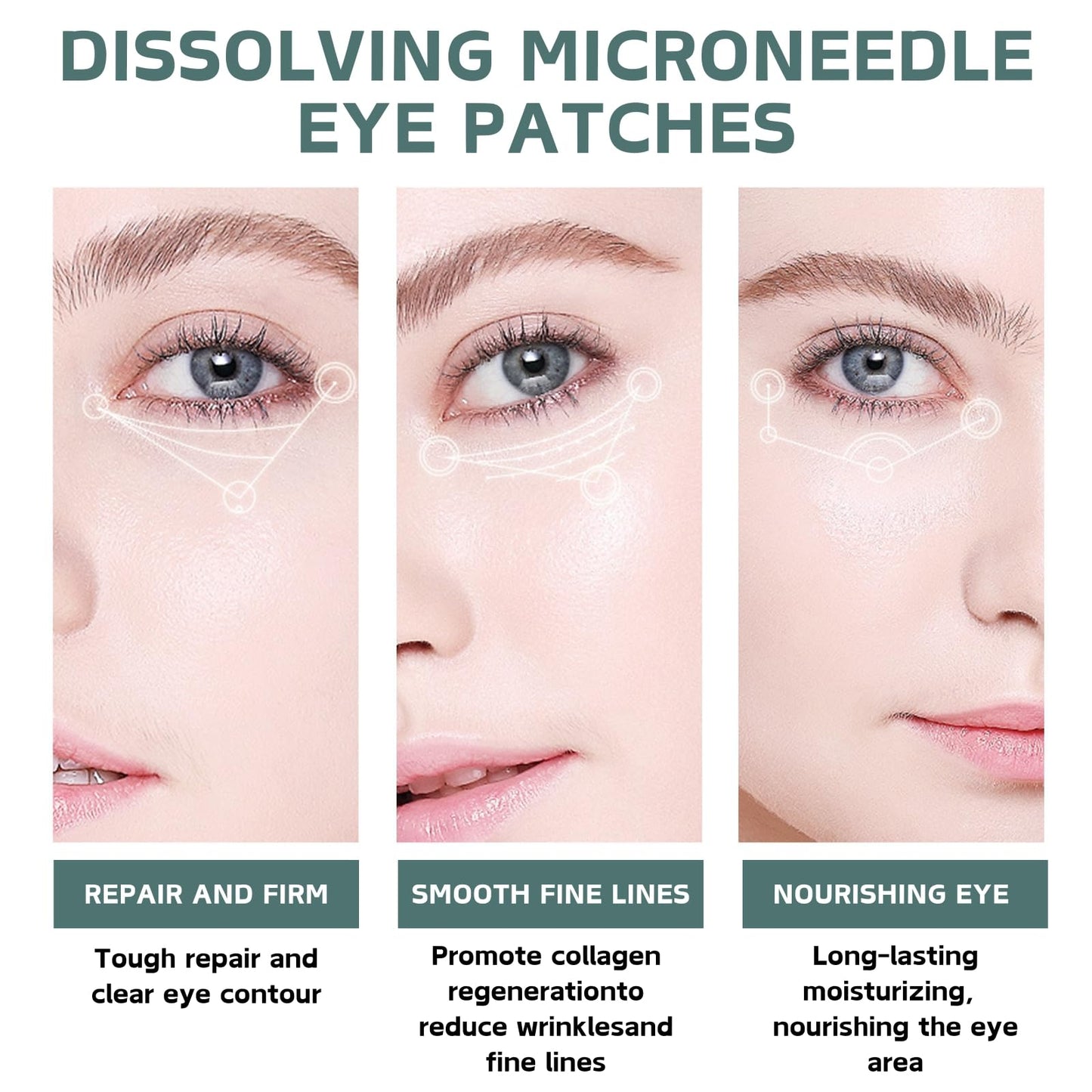 Cureluxe Pack of 5 Dissolving Microneedle Eye Patches,Dissolving Microneedle Eye Patches with Peptides,Hyaluronic acid,Glycerin,Anti Wrinkle Pat-ches,Under Eye Pat-ches for Dark Circles & Puffy Eyes