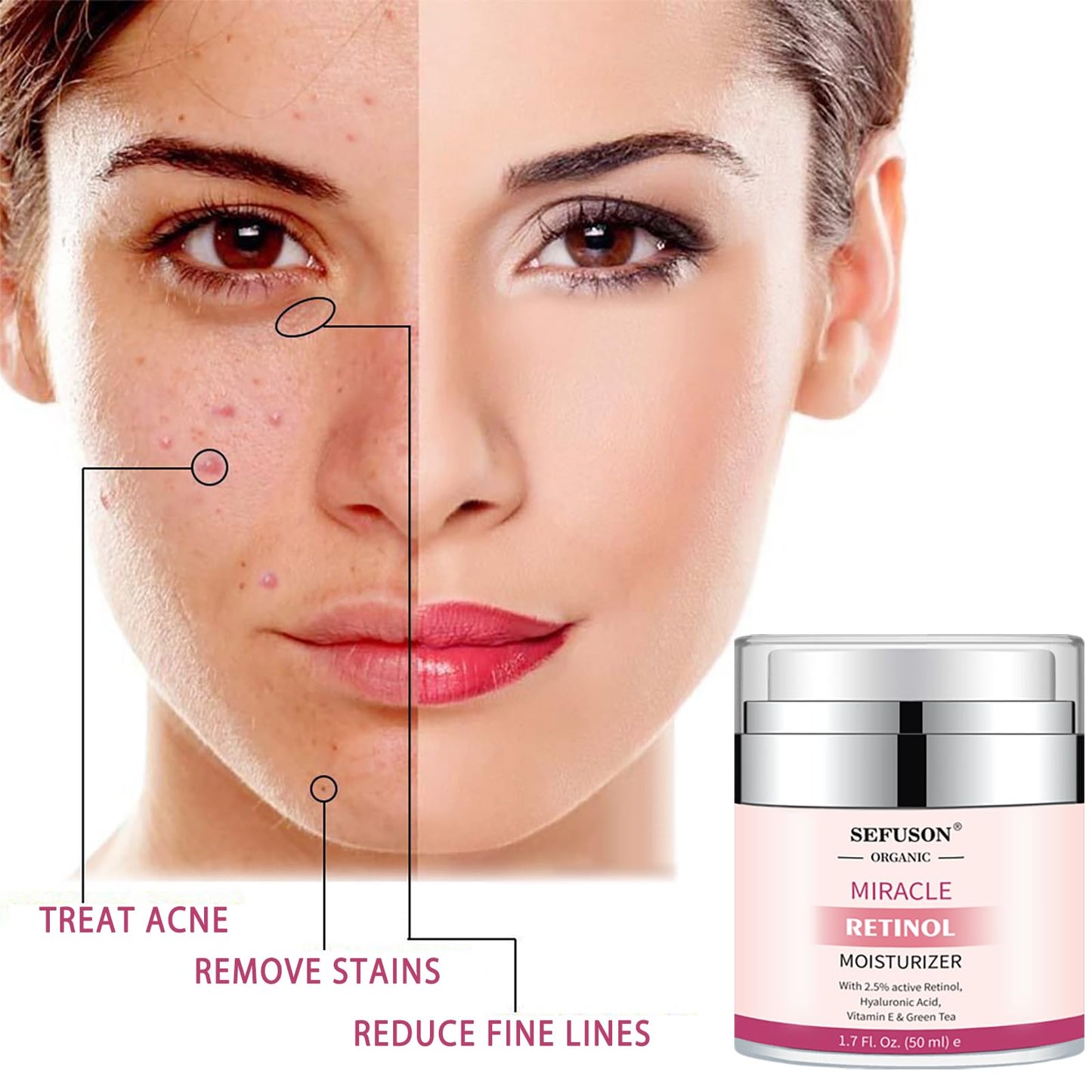 Retinol Moisturizer Cream,For Face&Eye Area Anti Aging Wrinkles & Acne & Fine Lines,with Vitamin E&Hyaluronic Acid & Jojoba Oil.Best Night&Day Facial Cream.With 2.5% Active Retinol (50Milliliter)