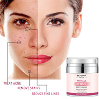 Retinol Moisturizer Cream,For Face&Eye Area Anti Aging Wrinkles & Acne & Fine Lines,with Vitamin E&Hyaluronic Acid & Jojoba Oil.Best Night&Day Facial Cream.With 2.5% Active Retinol (50Milliliter)