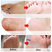 Tongyend Foot Peel Mask,3Pcs Natural Aloe Vera Gel Foot Mask,Foot Peel Mask For Hard Skin,Exfoliating Feet Peeling Socks,Foot Callus Remover,Foot Care,Feet Hard Skin Remover,Pedicure Sets For Feet (Lavender)