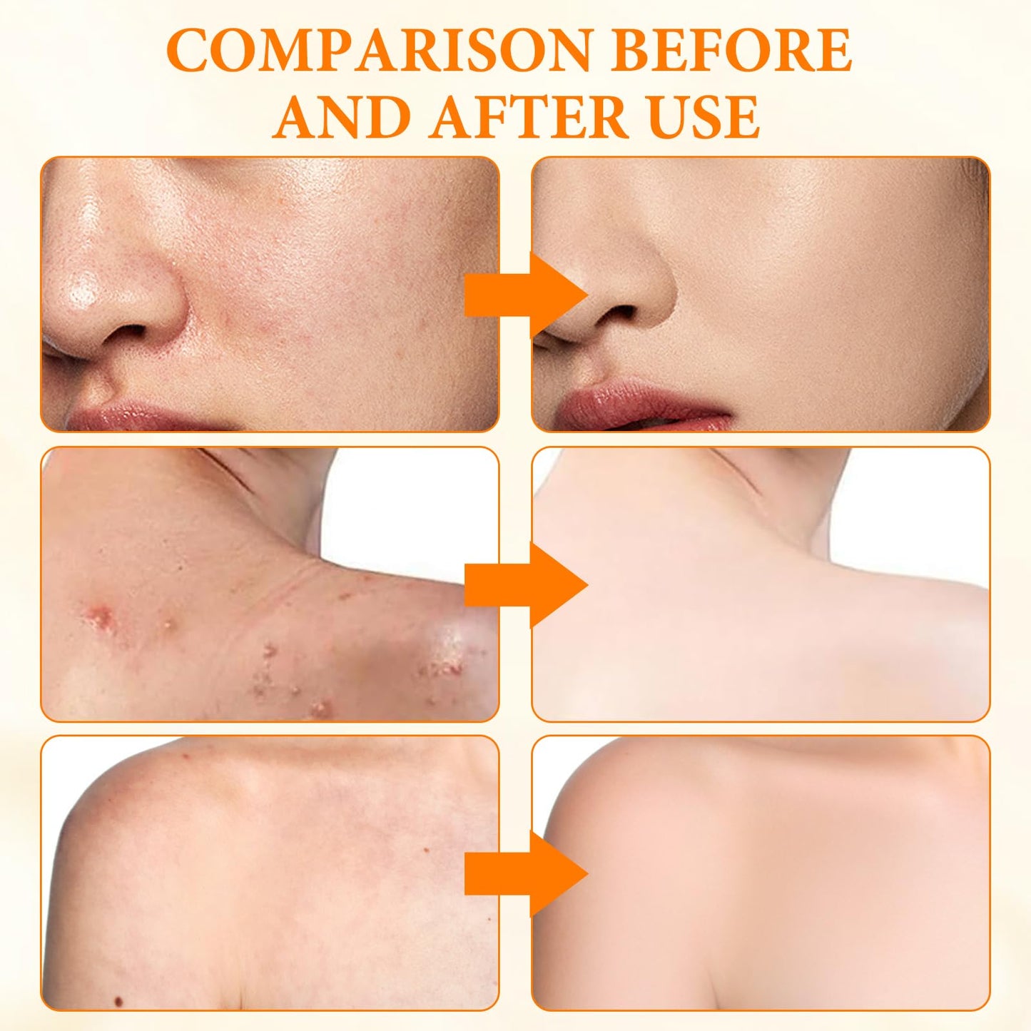 KDJXZ Turmeric Soap 2 Pieces Tumeric Soap Acne Dark Spot Smooth Skin, Turmeric Soap Bar, Turmeric Handmade Soap Bar Suitable for Moisturizing Restoring Elasticity Luster and Tightening Pores