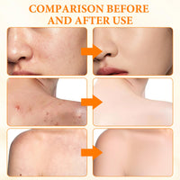 KDJXZ Turmeric Soap 2 Pieces Tumeric Soap Acne Dark Spot Smooth Skin, Turmeric Soap Bar, Turmeric Handmade Soap Bar Suitable for Moisturizing Restoring Elasticity Luster and Tightening Pores