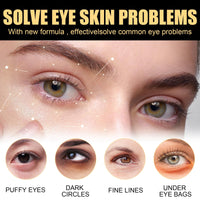 Jinjiar Caffeine & Hyaluronic Acid Under Eye Serum,Caffeine Eye Serum,Under Eye Cream for Dark Circles and Puffy Eyes,Eye Serum for Dark Circles,Eye Cream Anti Aging,Firming Eye Cream,Under Eye Treatment
