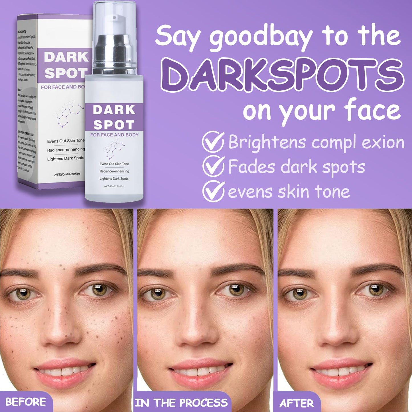Trendyfave 2Pcs Dark Spot Remover for Face & Body, Dark Spot Corrector Cream with Niacinamide & Hyaluronic Acid, Age Spot Remover, Melasma Cream for Sun Spots & Hyperpigmentation, Brightening, Even Skin Tone