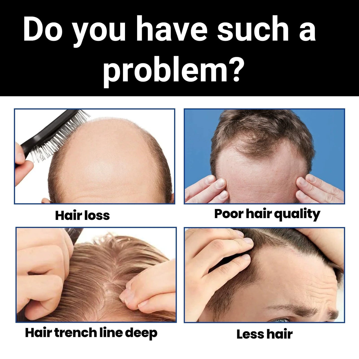 Hair Concealer,Hair Loss Concealer,Root Touch Up Hair Color,Water & Sweat Resistant Hair Loss Con-cealer,Easily Cover Loose Ha-ir,R-oot Cover Up,Ha-ir Root Touch Up,H-air Fibers for Men,Root Co-ver Up