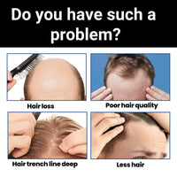 Hair Concealer,Hair Loss Concealer,Root Touch Up Hair Color,Water & Sweat Resistant Hair Loss Con-cealer,Easily Cover Loose Ha-ir,R-oot Cover Up,Ha-ir Root Touch Up,H-air Fibers for Men,Root Co-ver Up